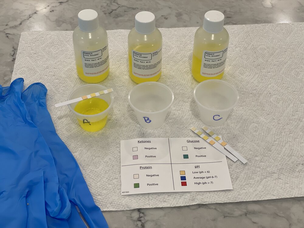 kidney filtration experiment