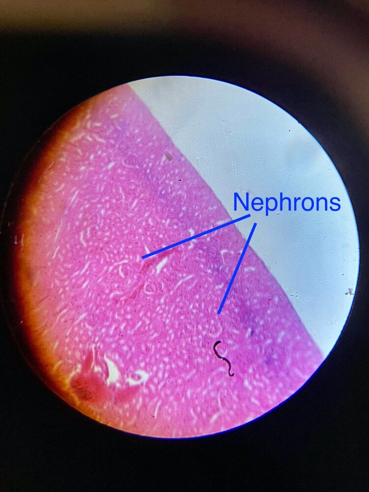 kidney slide with nephrons